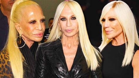 dove abita donatella versace|donatella versace face what happened.